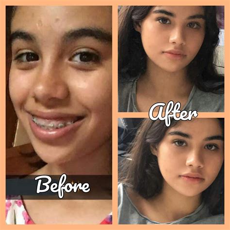 subliminal results amino|subliminal before and after.